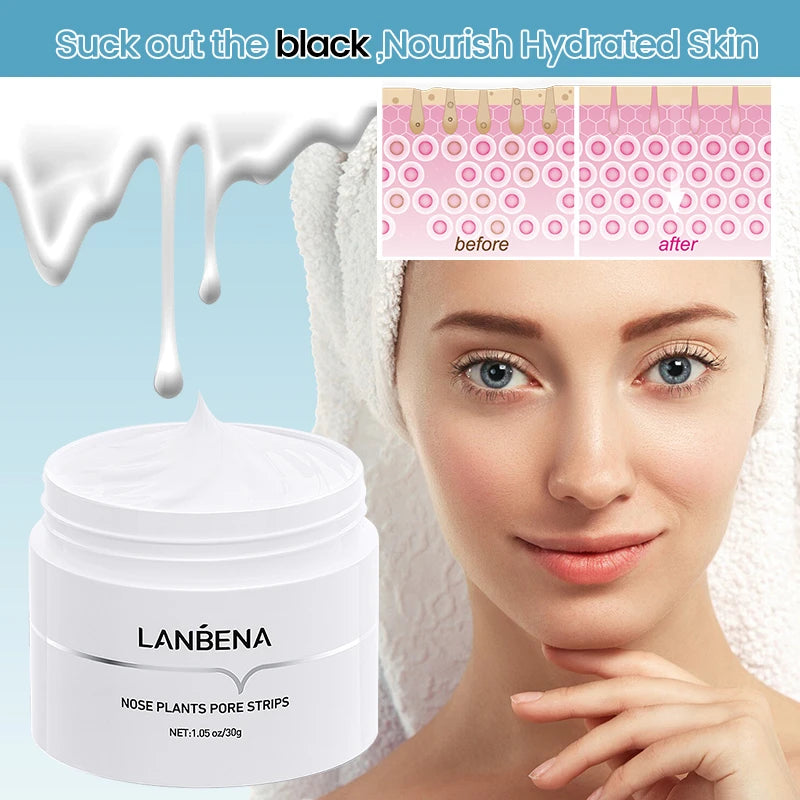 Deep Cleansing Blackhead Removal Mask