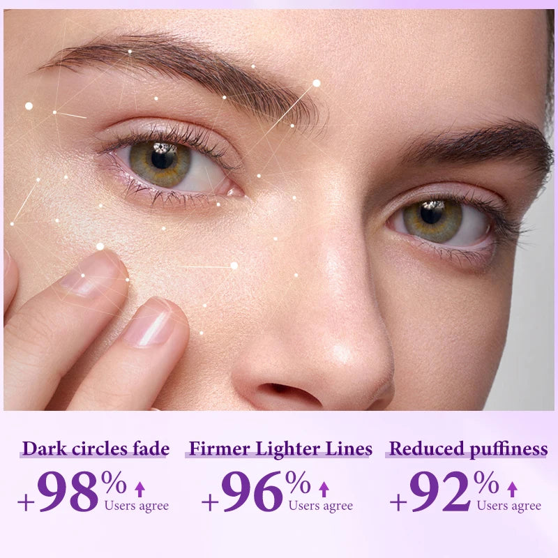 Retinol Eye Cream for Dark Circles and Wrinkles