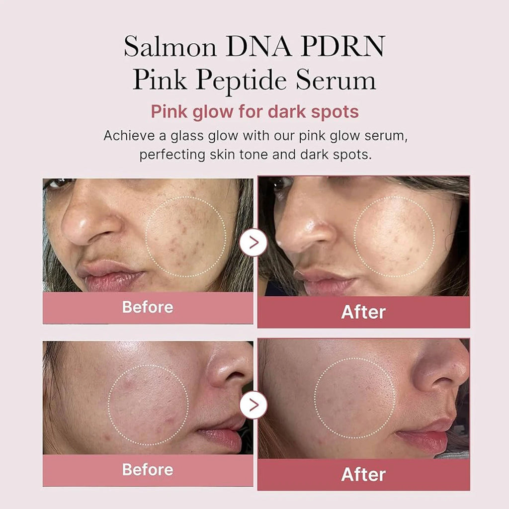 Medicube Salmon DNA PDRN Repair Serum