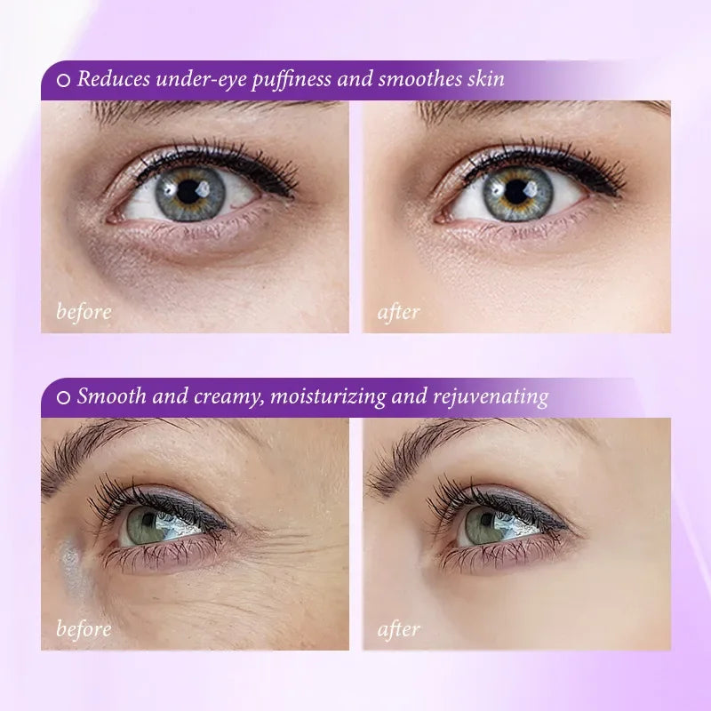 Retinol Eye Cream for Dark Circles and Wrinkles